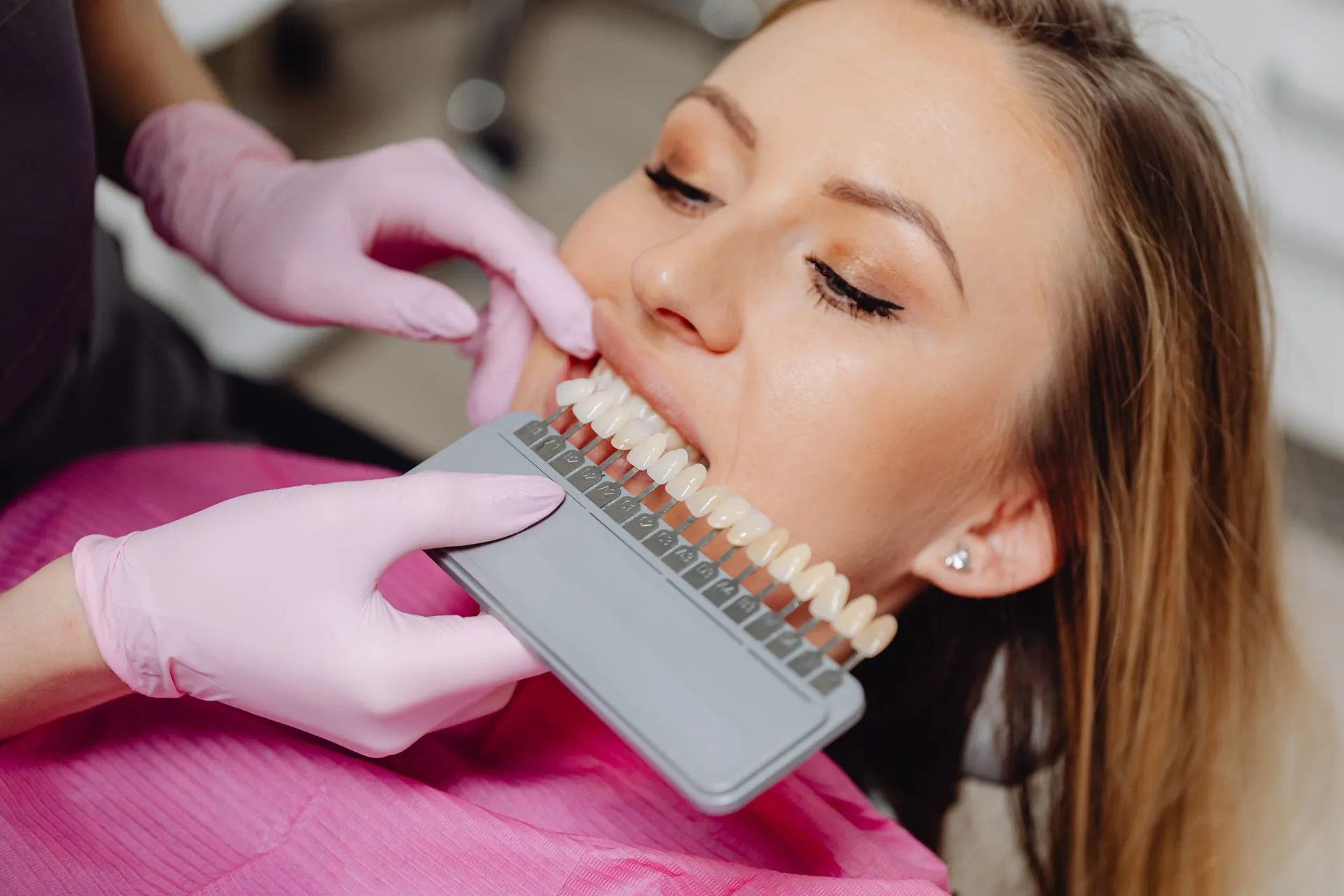 Selección del tono de los dientes con una guía de color durante un tratamiento de estética dental